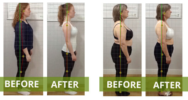 Improve Posture, Chiropractic Posture, Good and Bad Posture