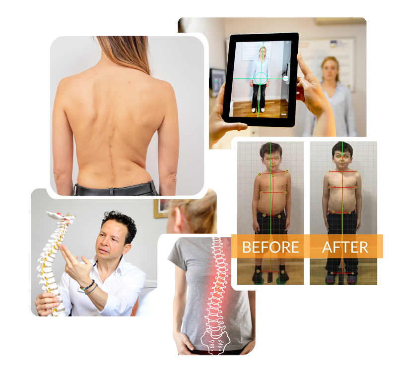 Compilation for all services scoliosis LOW RES