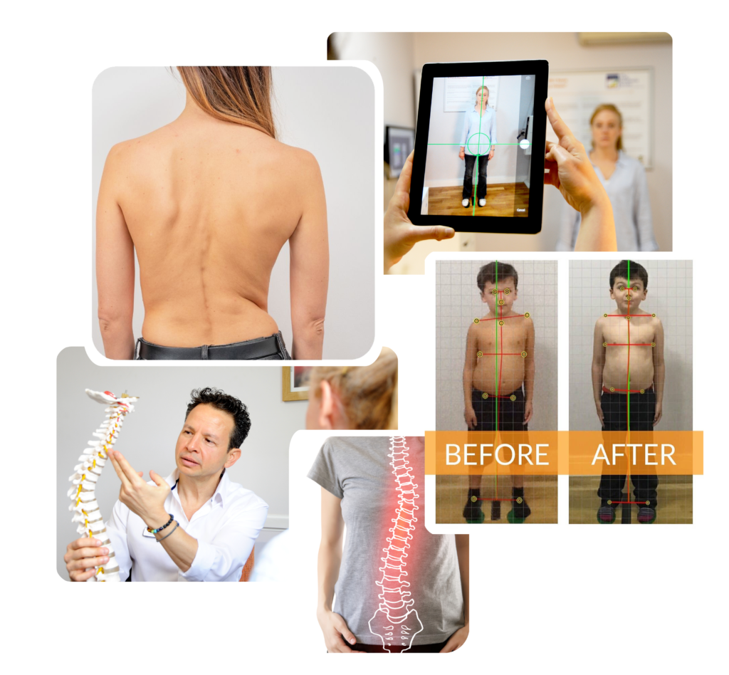 Compilation for all services scoliosis copy